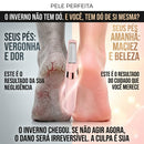 PéLiso Pro™ – Removedor Elétrico de Calos, Pele Seca e Rachaduras